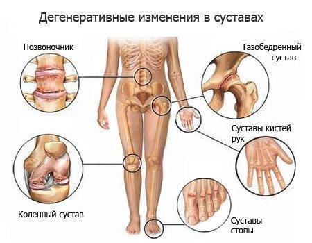 Профилактика травм и лечение суставов