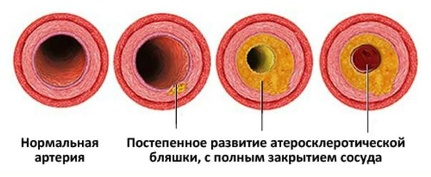 Значит дальше … 